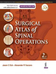 Surgical Atlas of Spinal Operations