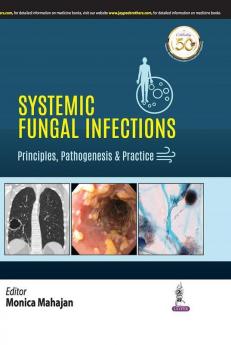 Systemic Fungal Infections