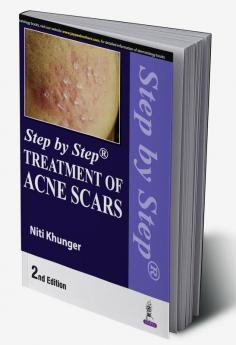 Step by Step Treatment of Acne Scars 2nd edition