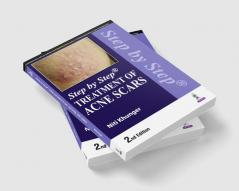 Step by Step Treatment of Acne Scars 2nd edition