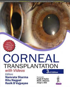 Corneal Transplantation