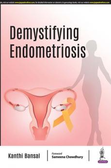 Demystifying Endometriosis