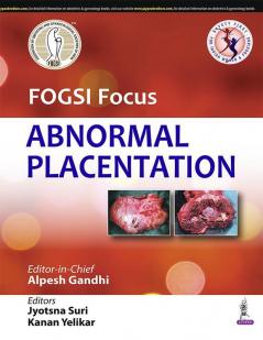 FOGSI Focus Abnormal Placentation