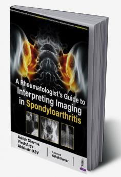 A Rheumatologist’s Guide to Interpreting Imaging in Spondyloarthritis