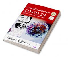 Clinical updates on COVID-19