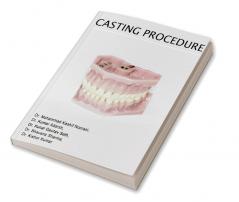 Casting Procedure