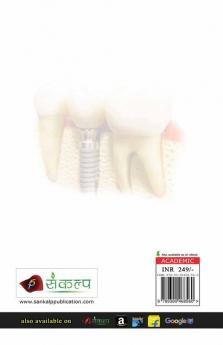 Implant Supported Overdenture