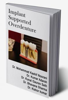 Implant Supported Overdenture