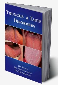 TONGUE AND TASTE DISORDERS