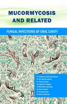 Mucormycosis and Related Fungal Infections of Oral Cavity