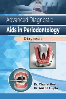 Advanced Diagnostic Aids in Periodontics