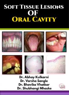 Soft Tissue Lesions Of Oral Cavity