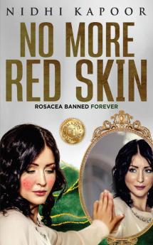 No More Red Skin: Rosacea banned forever