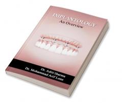 Implantology