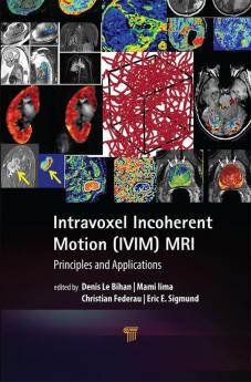 Intravoxel Incoherent Motion (IVIM) MRI