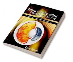 Retinal And Vitreoretinal Diseases And Surgery