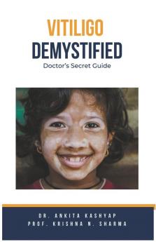 Vitiligo Demystified Doctors Secret Guide