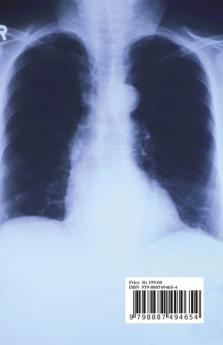 RESPIRATORY TRACT DISEASES