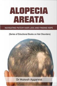 ALOPECIA AREATA