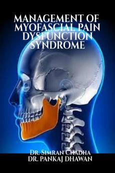 MANAGEMENT OF  MYOFASCIAL PAIN DYSFUNCTION SYNDROME