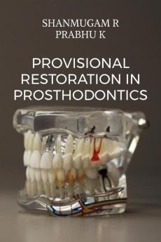Provisional Restoration in Prosthodontics : a prep guide