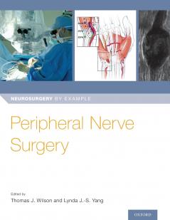 Peripheral Nerve Surgery