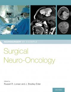Surgical Neuro-Oncology