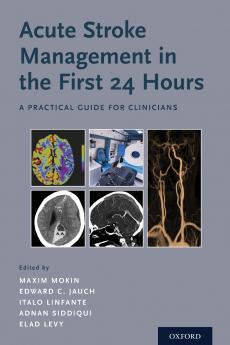 Acute Stroke Management in the First 24 Hours