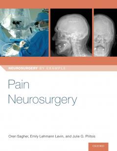 Pain Neurosurgery