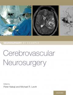 Cerebrovascular Neurosurgery