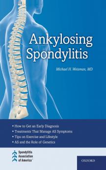 ANKYLOSING SPONDYLITIS C
