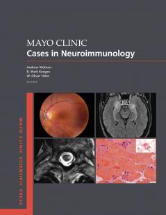 Mayo Clinic Cases in Neuroimmunology