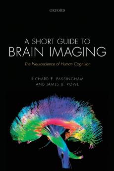 Short Guide to Brain Imaging