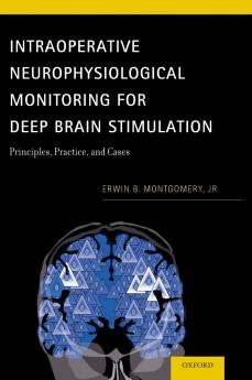 Intraoperative Neurophysiological Monitoring for Deep Brain Stimulation