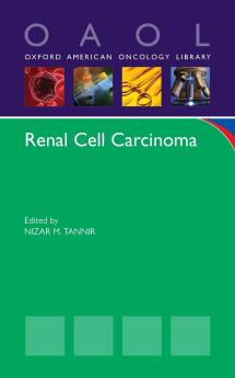 Renal Cell Carcinoma