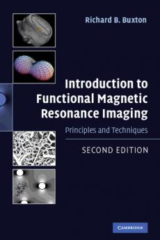 Introduction to Functional Magnetic Resonance Imaging