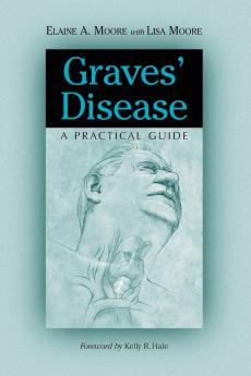 Graves' Disease