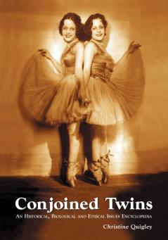 Conjoined Twins