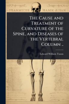 Cause and Treatment of Curvature of the Spine and Diseases of the Vertebral Column ..