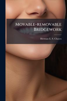 Movable-removable Bridgework
