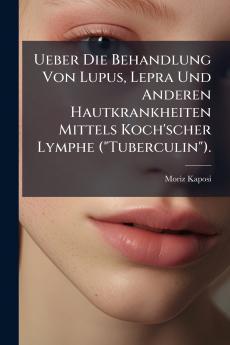 Ueber Die Behandlung Von Lupus Lepra Und Anderen Hautkrankheiten Mittels Koch'scher Lymphe (Tuberculin).