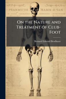 On the Nature and Treatment of Club-Foot