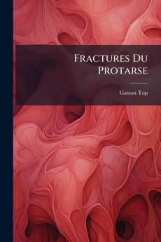 Fractures Du Protarse