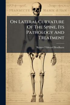 On Lateral Curvature Of The Spine Its Pathology And Treatment