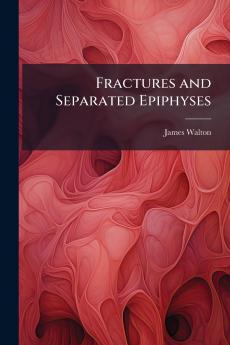 Fractures and Separated Epiphyses