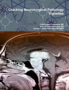 Cracking Neurosurgical Pathology Vignettes