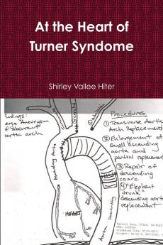 At The Heart of Turner Syndrome
