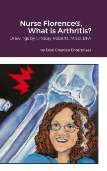 Nurse Florence® What is Arthritis?