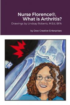 Nurse Florence® What is Arthritis?