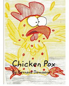 Chicken Pox